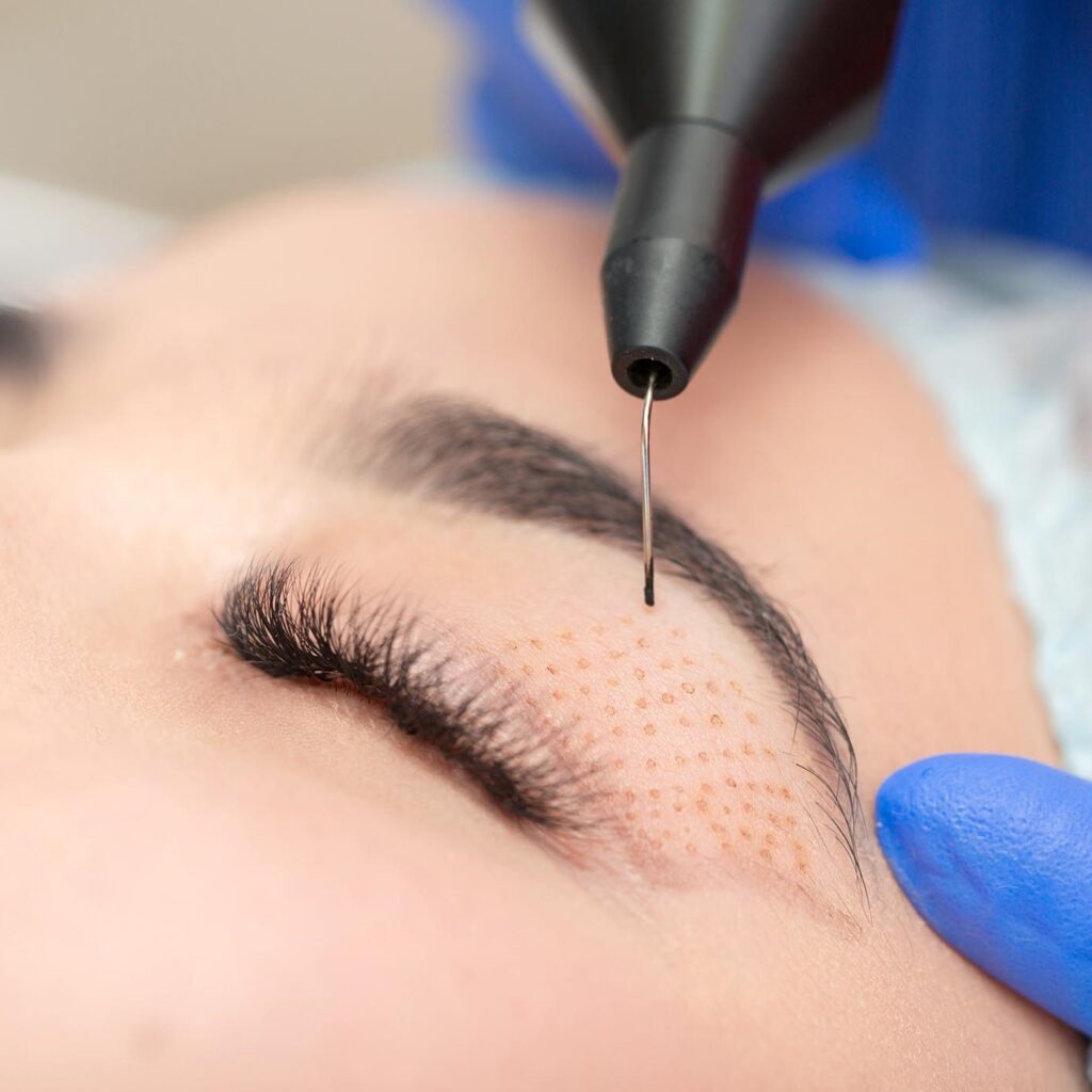 Dermal Fillers Treatment in Islamabad